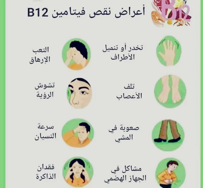 نقص فيتامين ب12