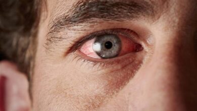 قطرات العين لعلاج حساسية العين