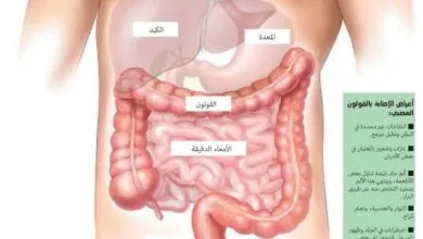 أسباب وأعراض القولون العصبي وكيفية التعامل معها