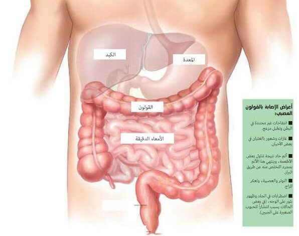 أسباب وأعراض القولون العصبي وكيفية التعامل معها