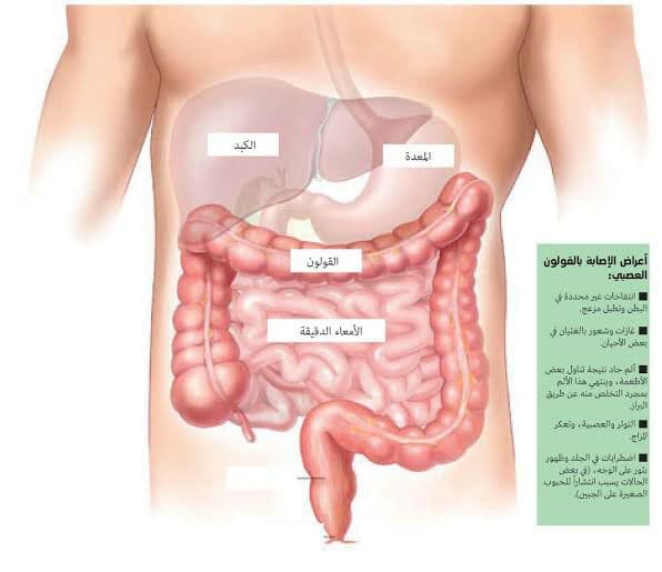 أسباب وأعراض القولون العصبي وكيفية التعامل معها