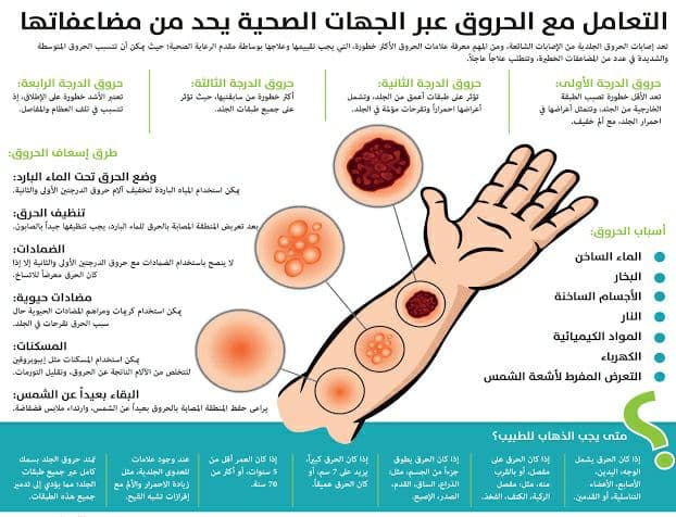 أنواع الحروق وكيفية التعامل معها