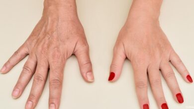كريم يدين لعلاج تجاعيد اليدين وتسمين اليدين بالكولاجين
