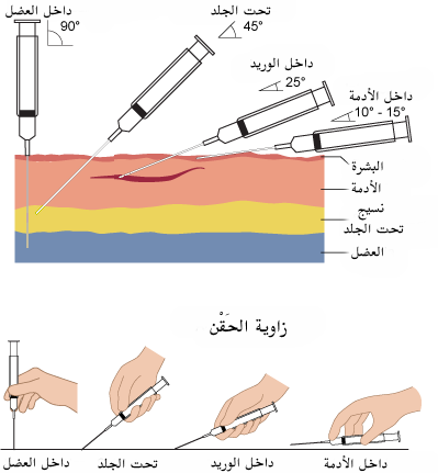 الطريقة الصحيحة لـ الحقن العضلي