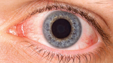 قطرات مرطبة للعين لعلاج أعراض جفاف واحمرار العين