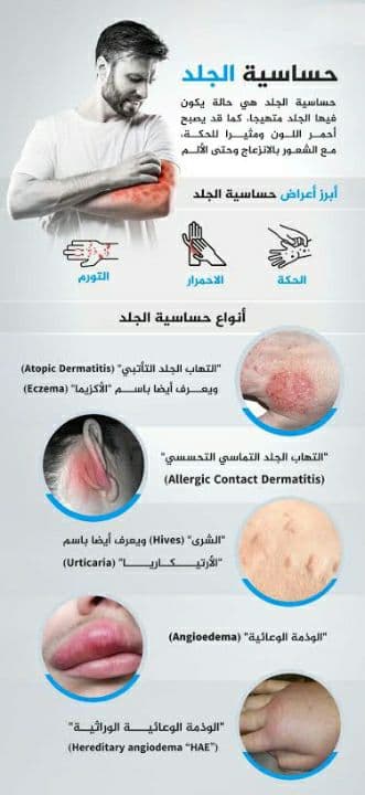 علاج حساسية الجلد