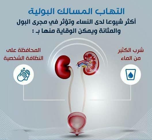 فوار لـ علاج حرقة البول