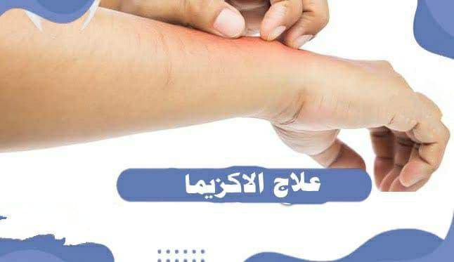 كريمات ومراهم لـ التخلص من أعراض الإكزيما