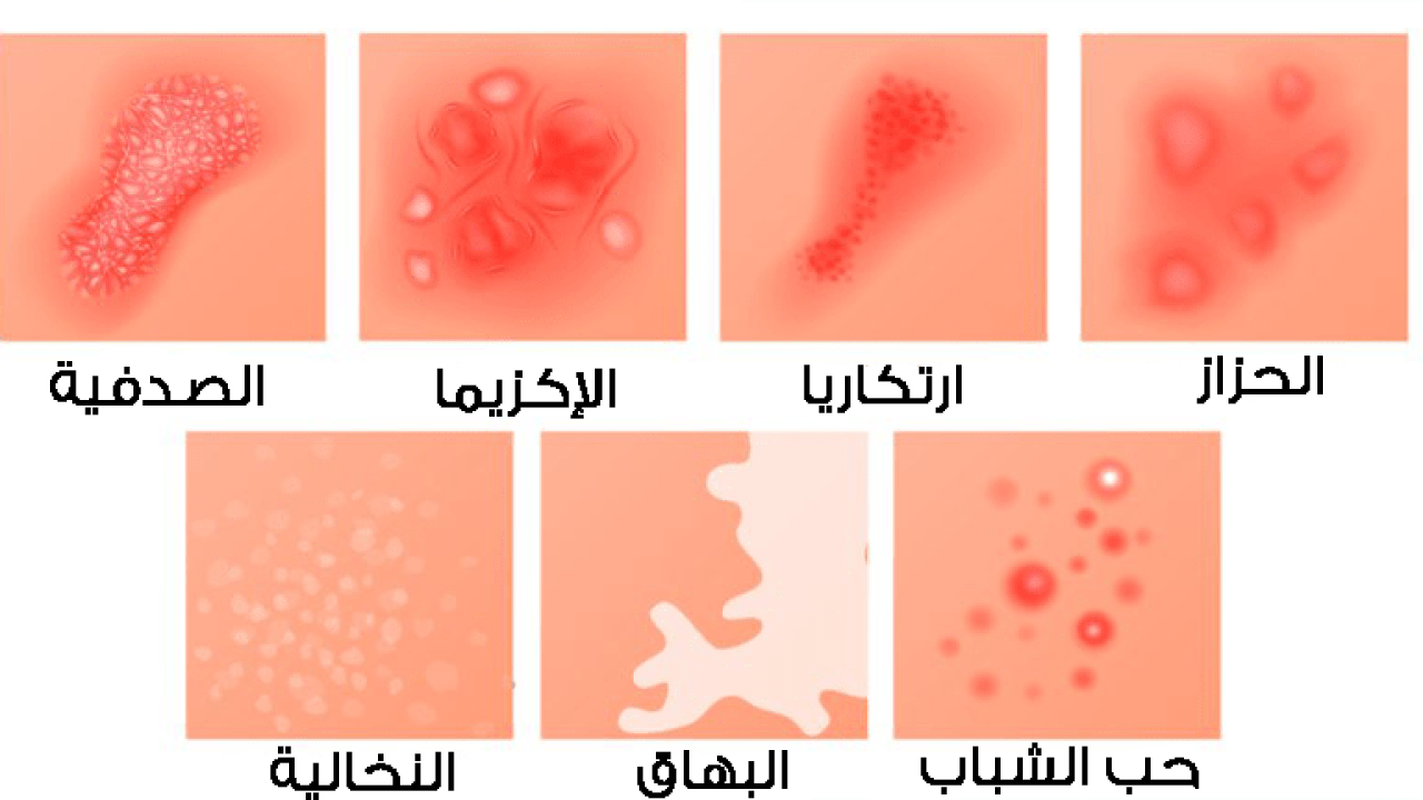 أسباب وأعراض ظهور نقط / بقع حمراء على الذراعين