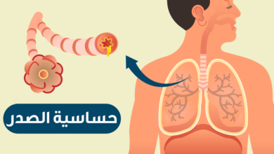 شراب حساسيه الصدر وطرق العلاج بالاعشاب الطبيعية