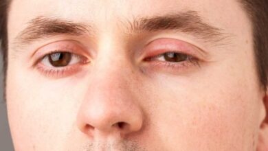 قطرة عين مضاد حيوي لعلاج التهاب جفن العين