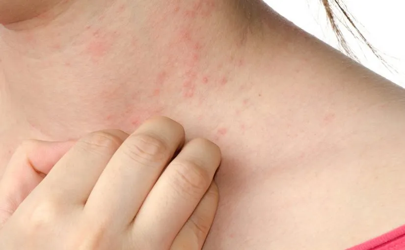 مرهم جلينوساليك Glenosalic مرهم جلينوساليك Glenosalic لـ علاج أعراض الحساسية الجلدية والالتهابات