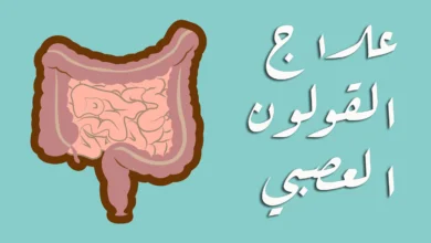علاج القولون العصبي