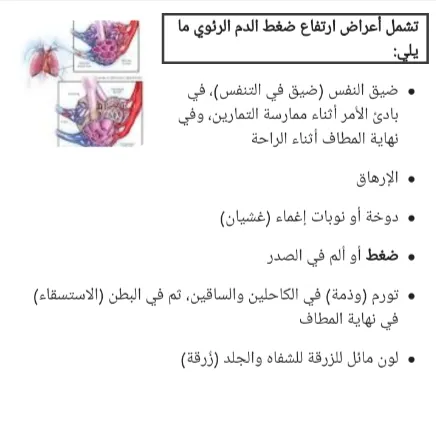 ارتفاع ضغط الدم أعراض ارتفاع ضغط الدم