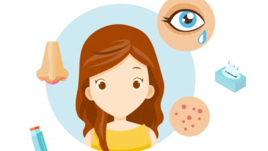 أسباب وأعراض حساسية الأطفال