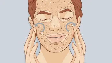 أساليب تقشير الوجه