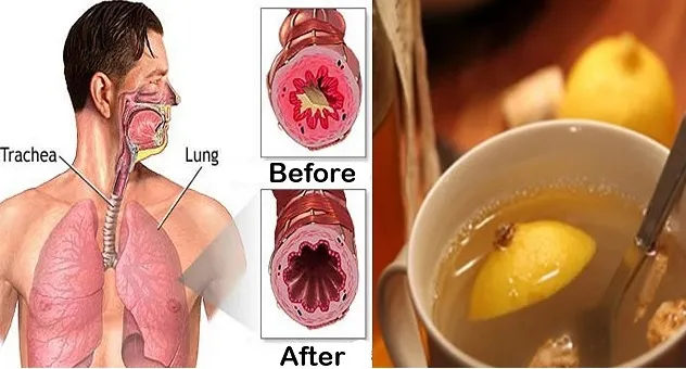 طرد البلغم طرد البلغم بـ الأعشاب والأدوية