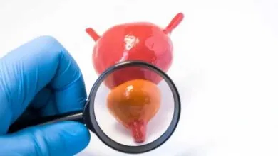 علاج البروستاتا بزيت الزيتون
